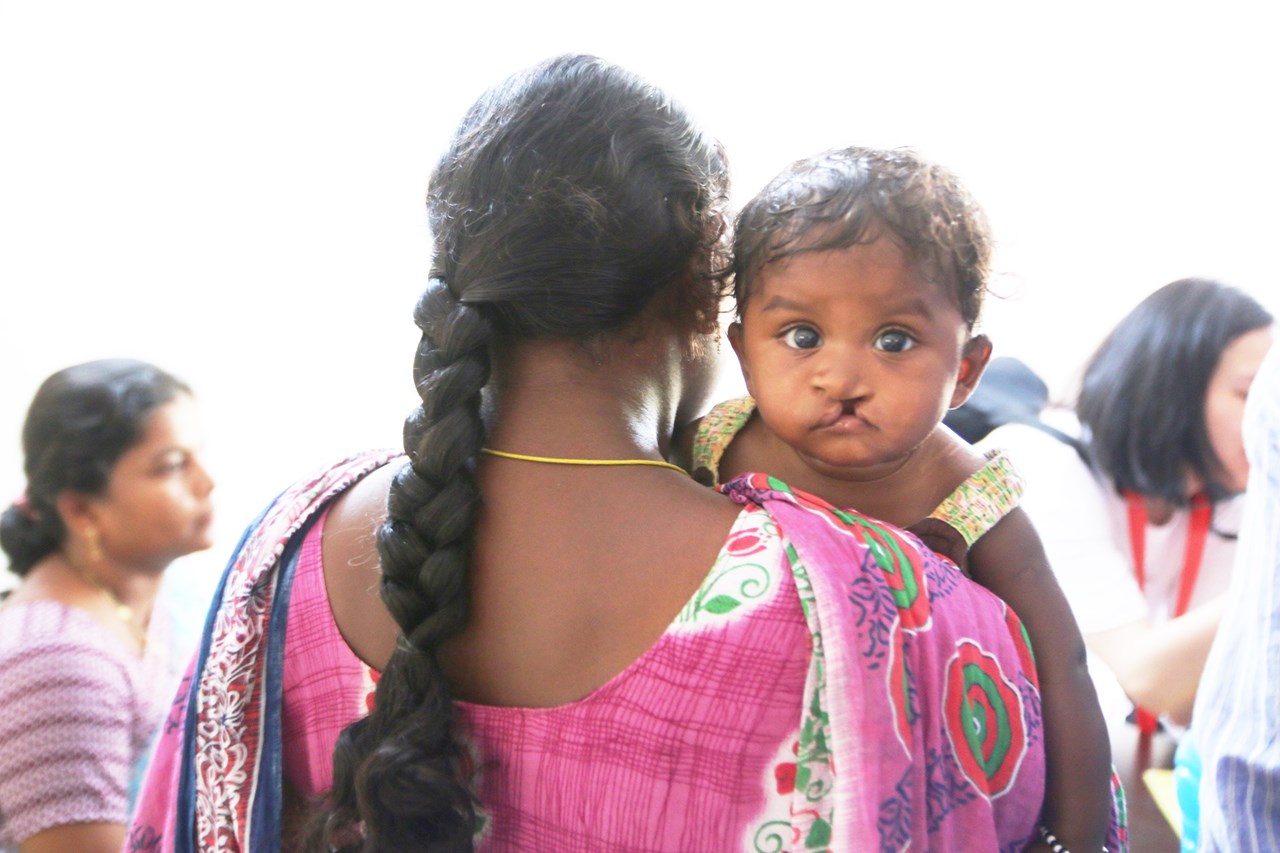 Operation Smile India mission